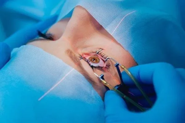 Is LASIK Right for You? Everything You Need to Know